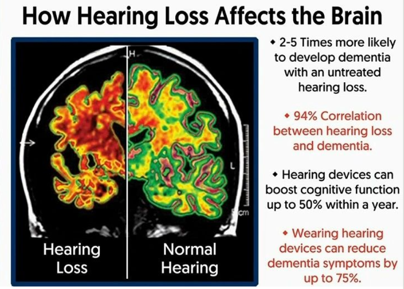 How hearing loss affects the brain - Ottawa Hears